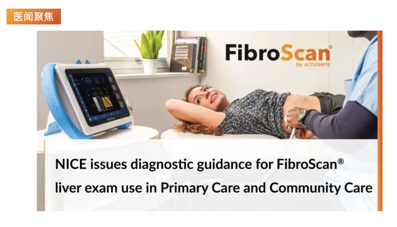 医闻聚焦 | NICE发布具有里程碑意义的指导意见，将常规肝脏扫描引入初级保健机构